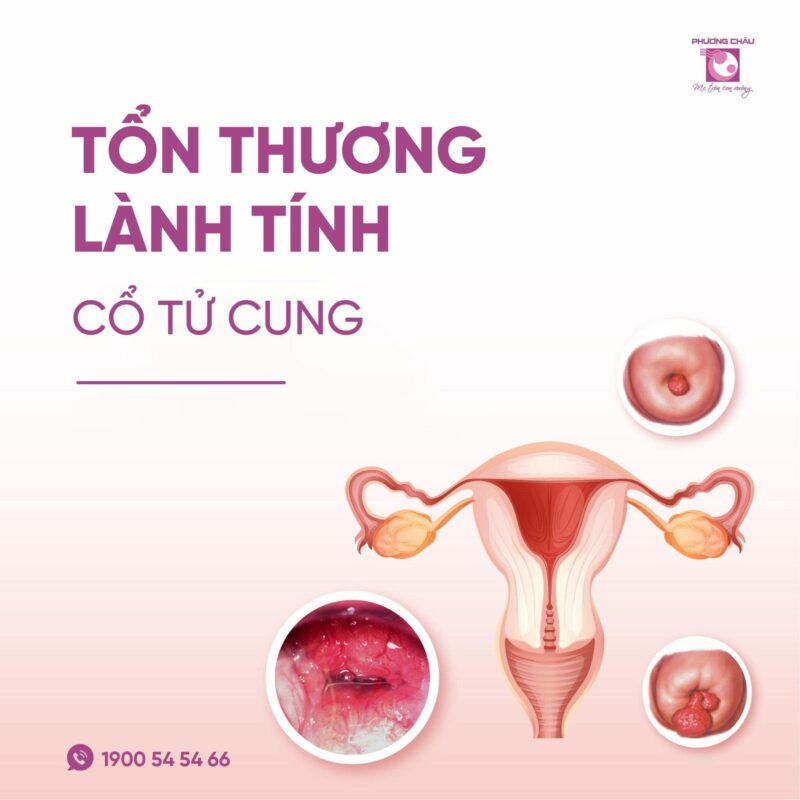 cac-ton-thuong-lanh-tinh-co-tu-cung-new