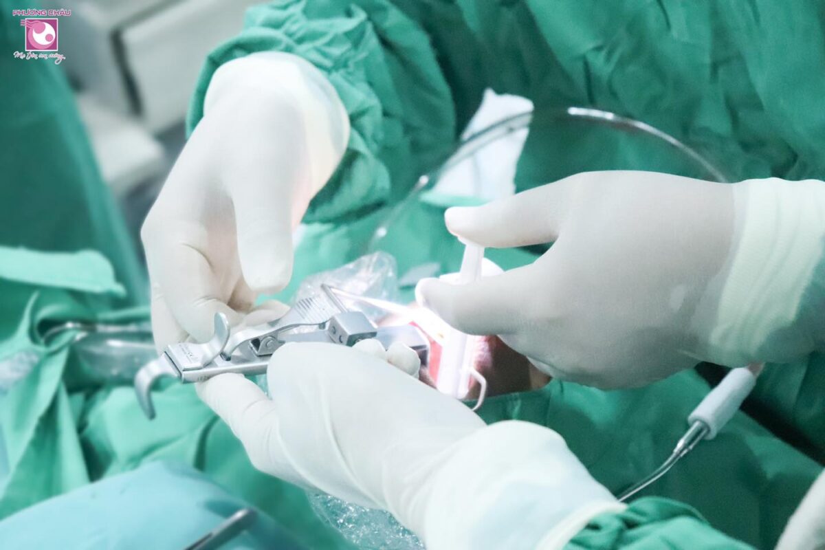 phẫu thuật amidan an toàn xuất viện trong ngày